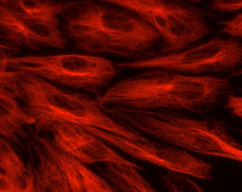 Dengue